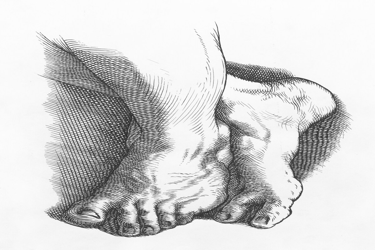 Illustration showing gout deformity in the foot and big toe joint, highlighting the impact of stress and gout on joint inflammation.